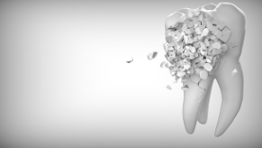 이빨 빠지는 꿈