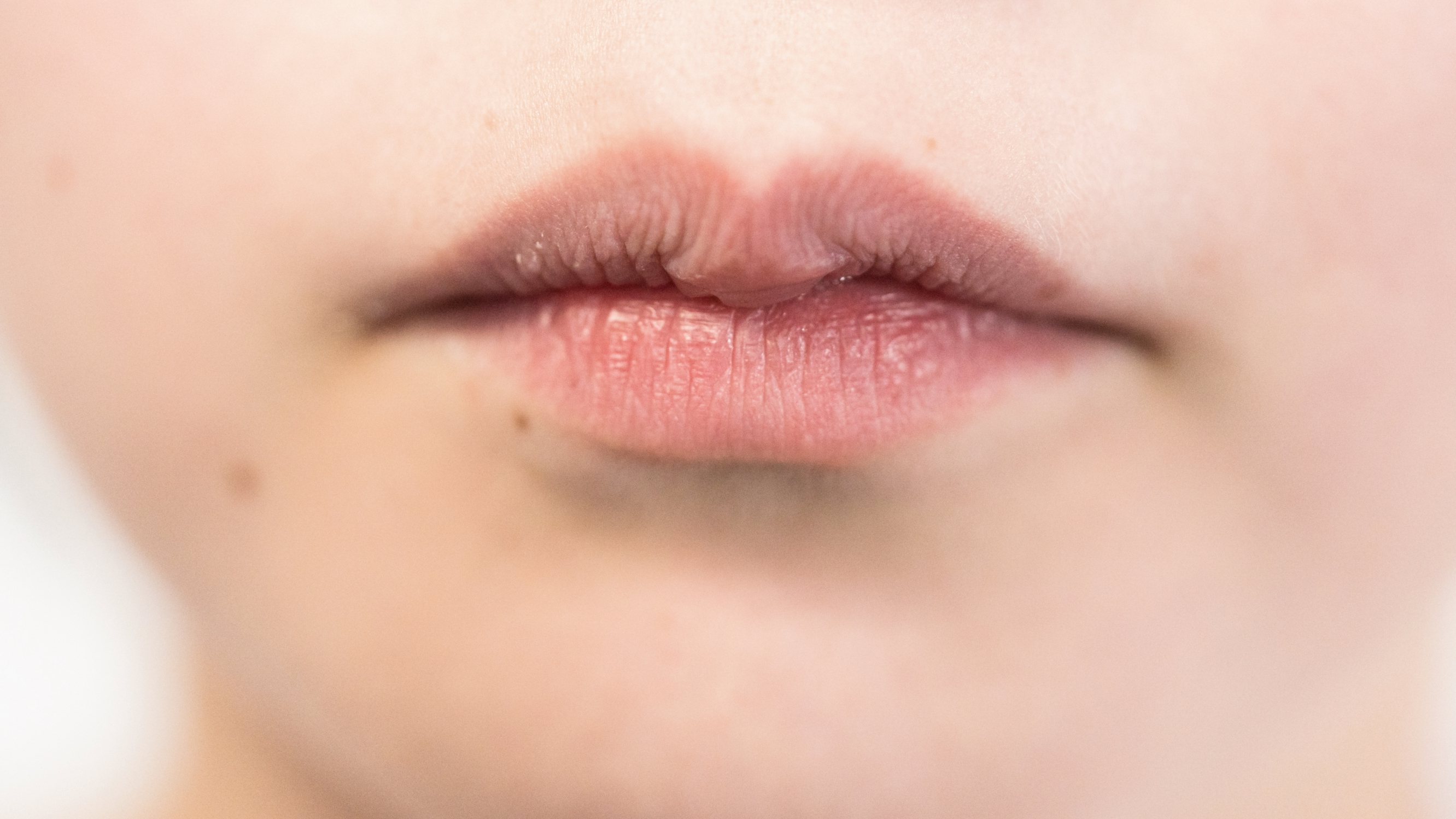 입술 헤르페스 예방 방법