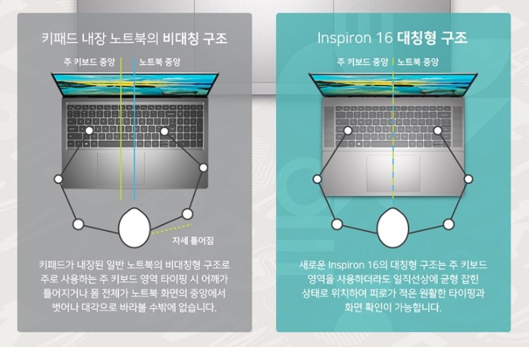 대칭형구조