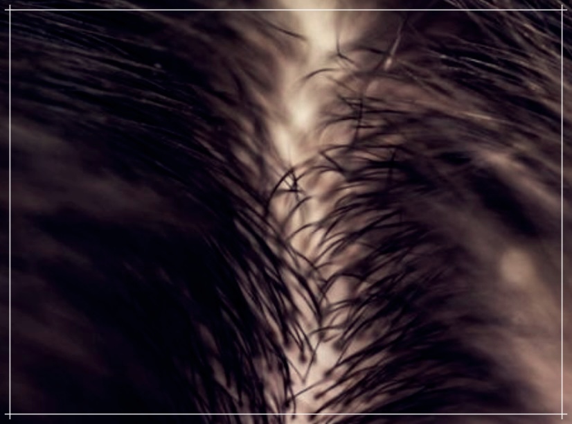 머리카락 굵어지는 방법