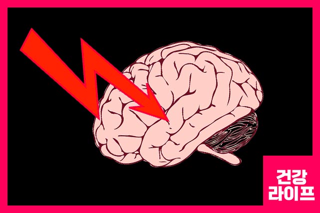 뇌경색 전조증상 5가지