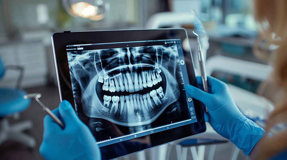 임플란트 시술과정