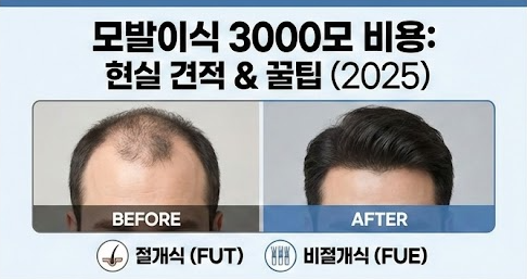 모발이식 3000모 비용