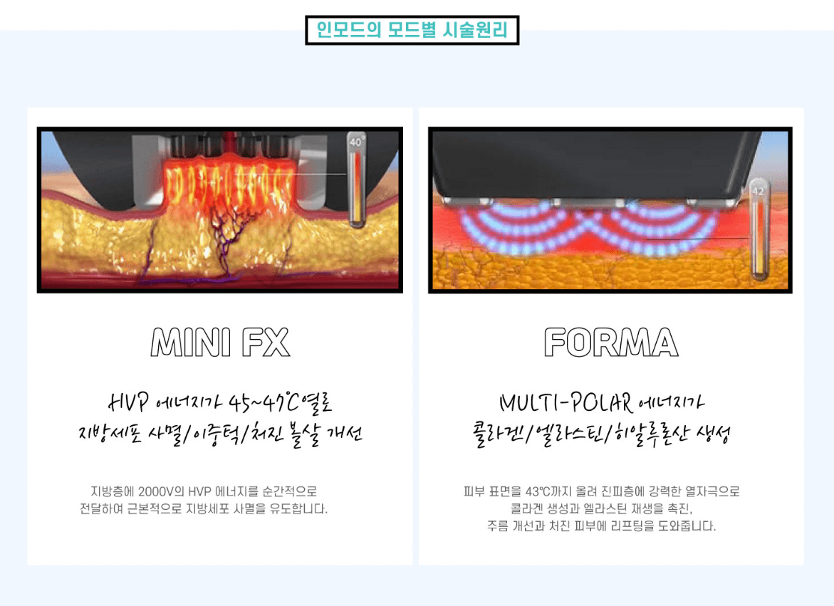 울쎄라 대체 가능한 HIFU 초음파 리프팅레이저 종류와 효과 가격비교