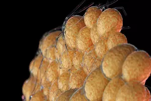 내장지방-빼는법