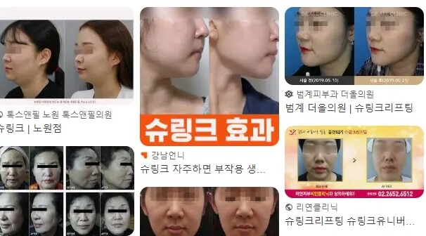 슈링크