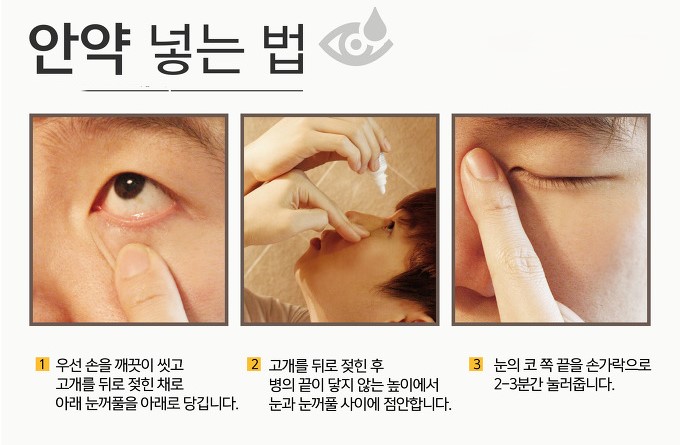 프레드벨 1% 점안액 완벽 가이드