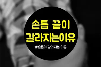 손톱이 갈라지는 이유 원인 증상 대처법_20