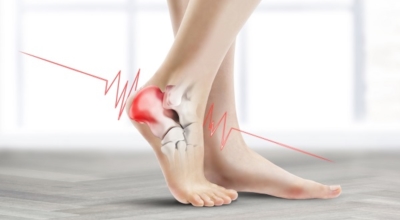 족저근막염 이미지