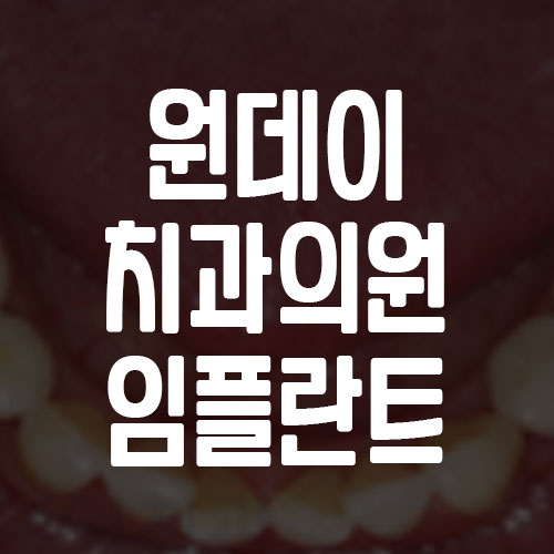원데이치과의원 임플란트 가격