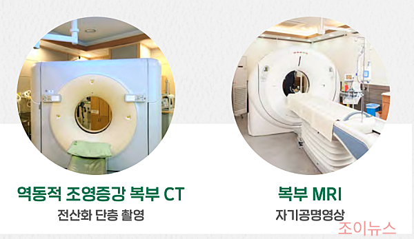 간암 진단 방법 - 영상 검사