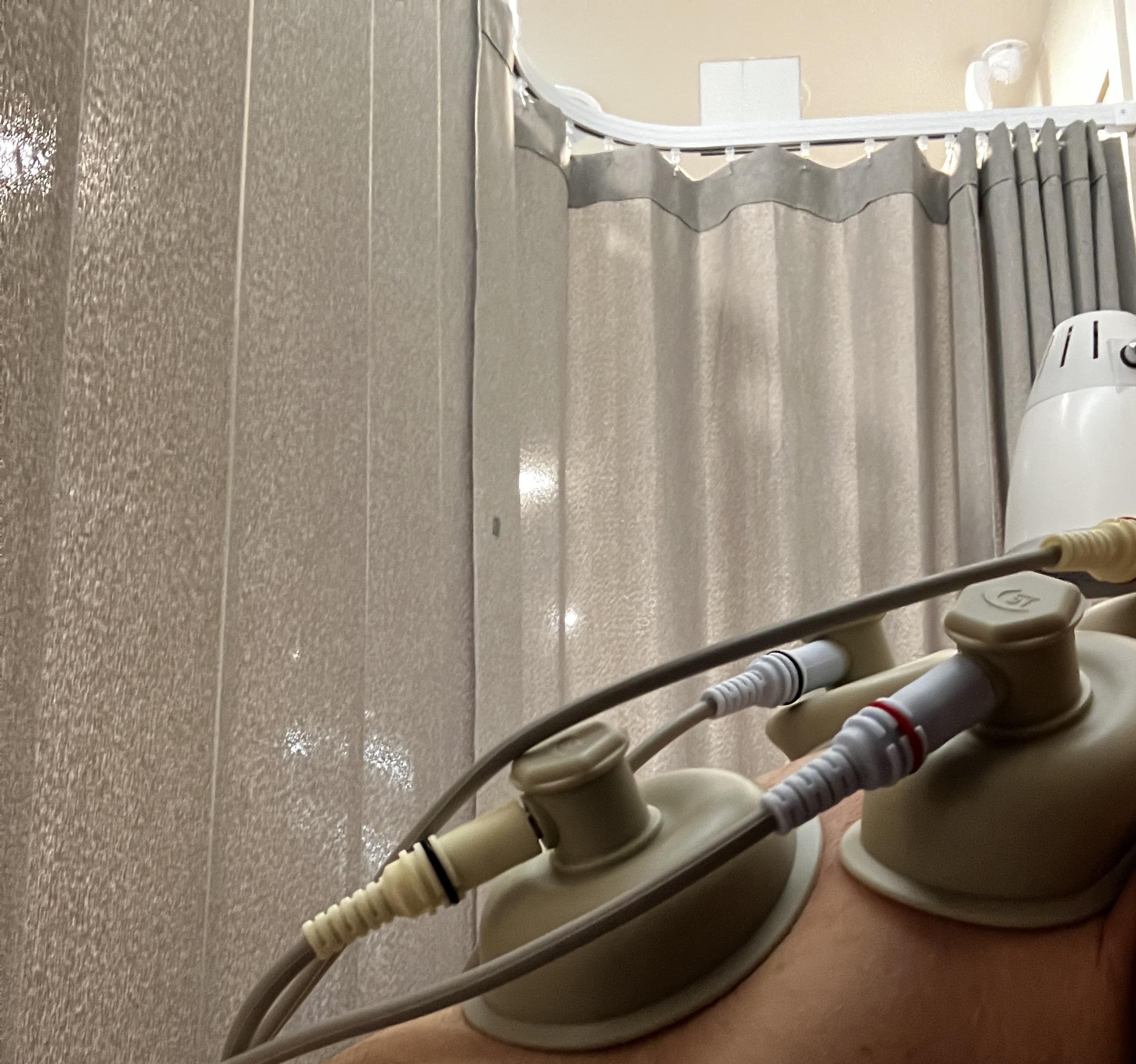 하늘애한의원 치료후기