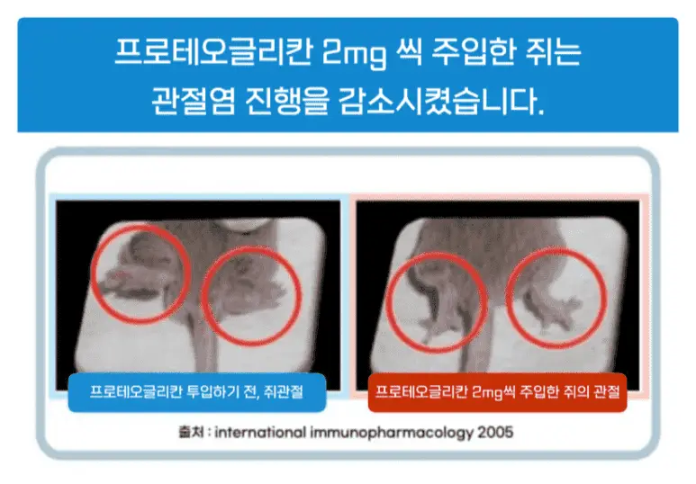 무릎관절영양제