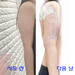 팔뚝무한람스 후기 1일차.