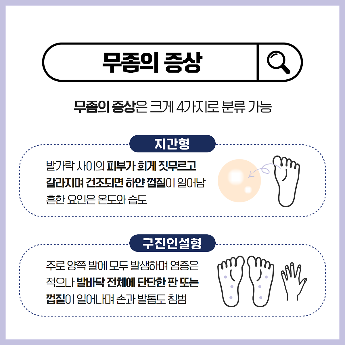 2026 발톱무좀 완치 루틴 공개｜약보다 중요한 4단계 관리법