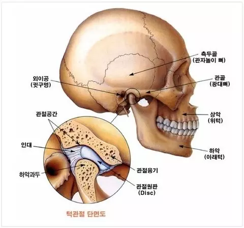암 후유증 개구장애