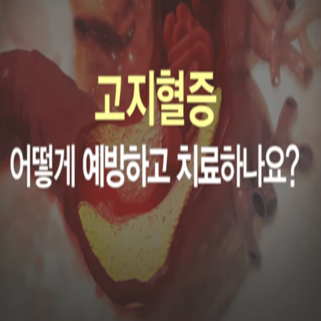 고지혈증 예방과 치료