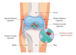 노인-무릎-인공-관절-수술-지원-2