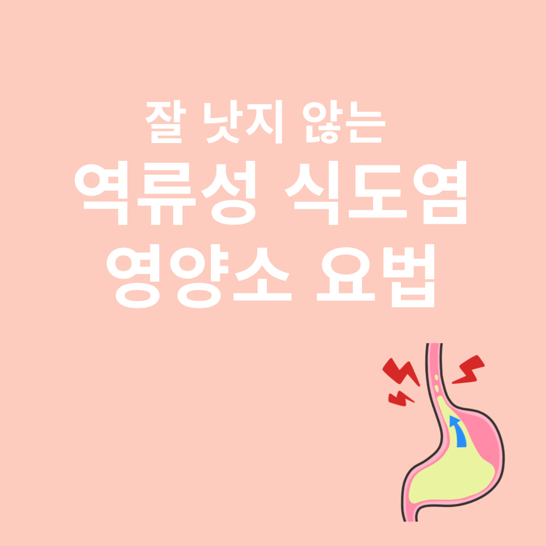 역류성 식도염과 관련된 자료