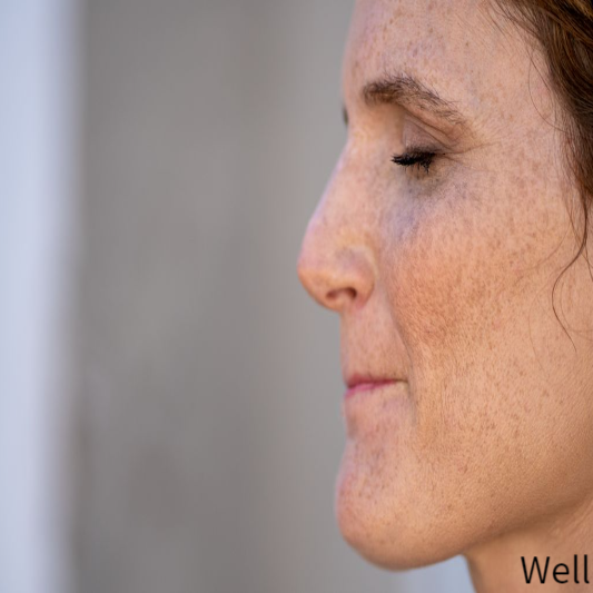 기미 없애는 방법