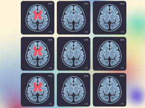 혈관조영술 검사