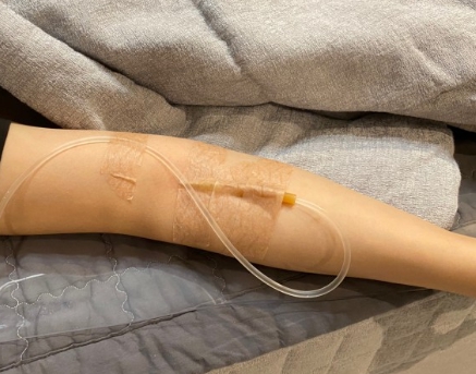 백옥주사 실제 시술 장면