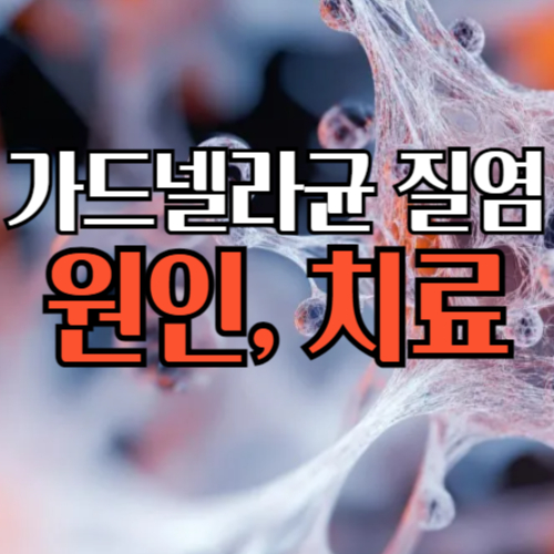 가드넬라균질염 원인과치료