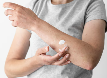 스테로이드 부작용 14