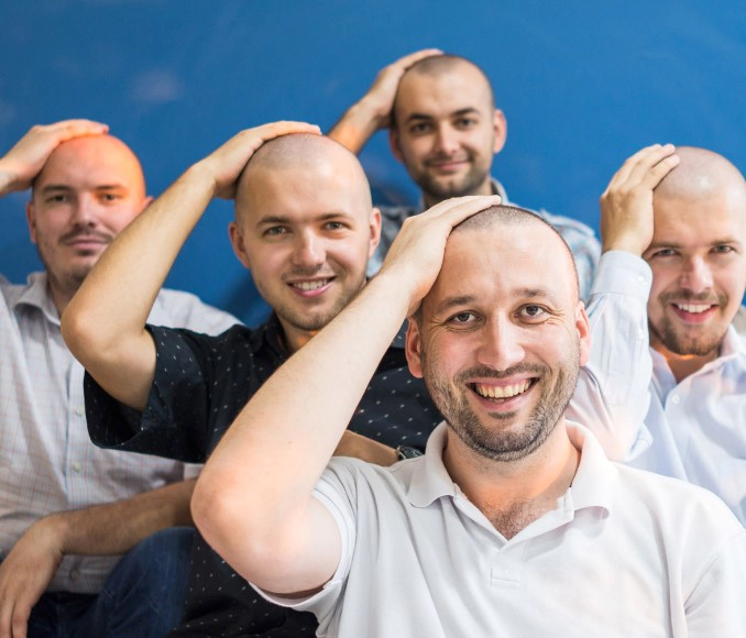 탈모 유전자 종류 확률 모계유전 검사 정리