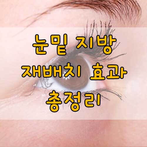 눈밑지방재배치&#44; 눈밑 지방 재배치로 개선할 수 있는 것과 없는 것