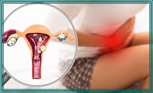 임신 중 질염 생기는 이유 10가지