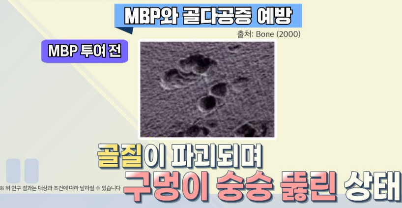 MBP 효능