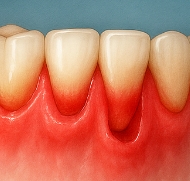 잇몸이 붓고 아플 때