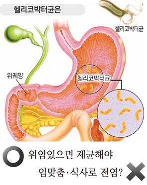 헬리코박터균 전염 확률 원인 경로 증상 검사 약 치료 예방 건강검진 총정리1