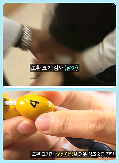고환 크기검사 중인 남아_이미지출처:생로병사유튜브