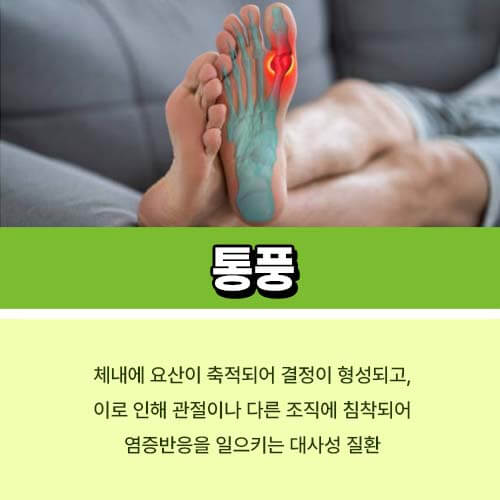 통풍에_좋은_차