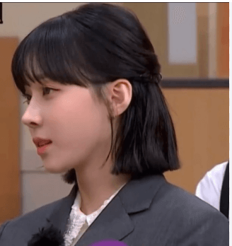 코성형수술-윈터코-성형외과초성