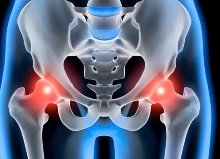 고관절 통증 7일 완화 루틴