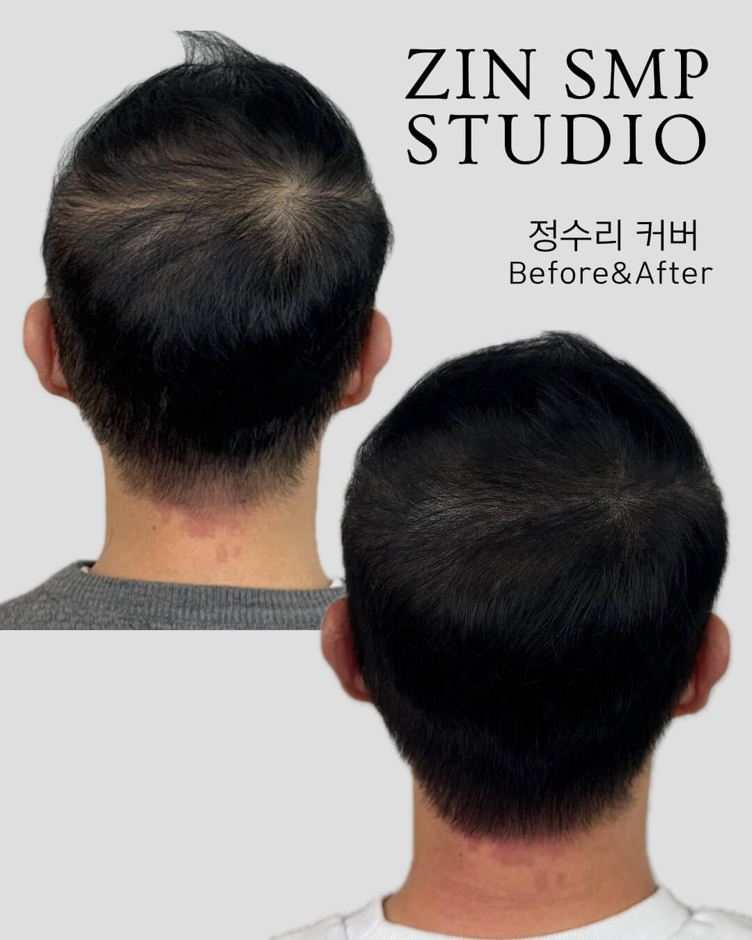 두피문신후기