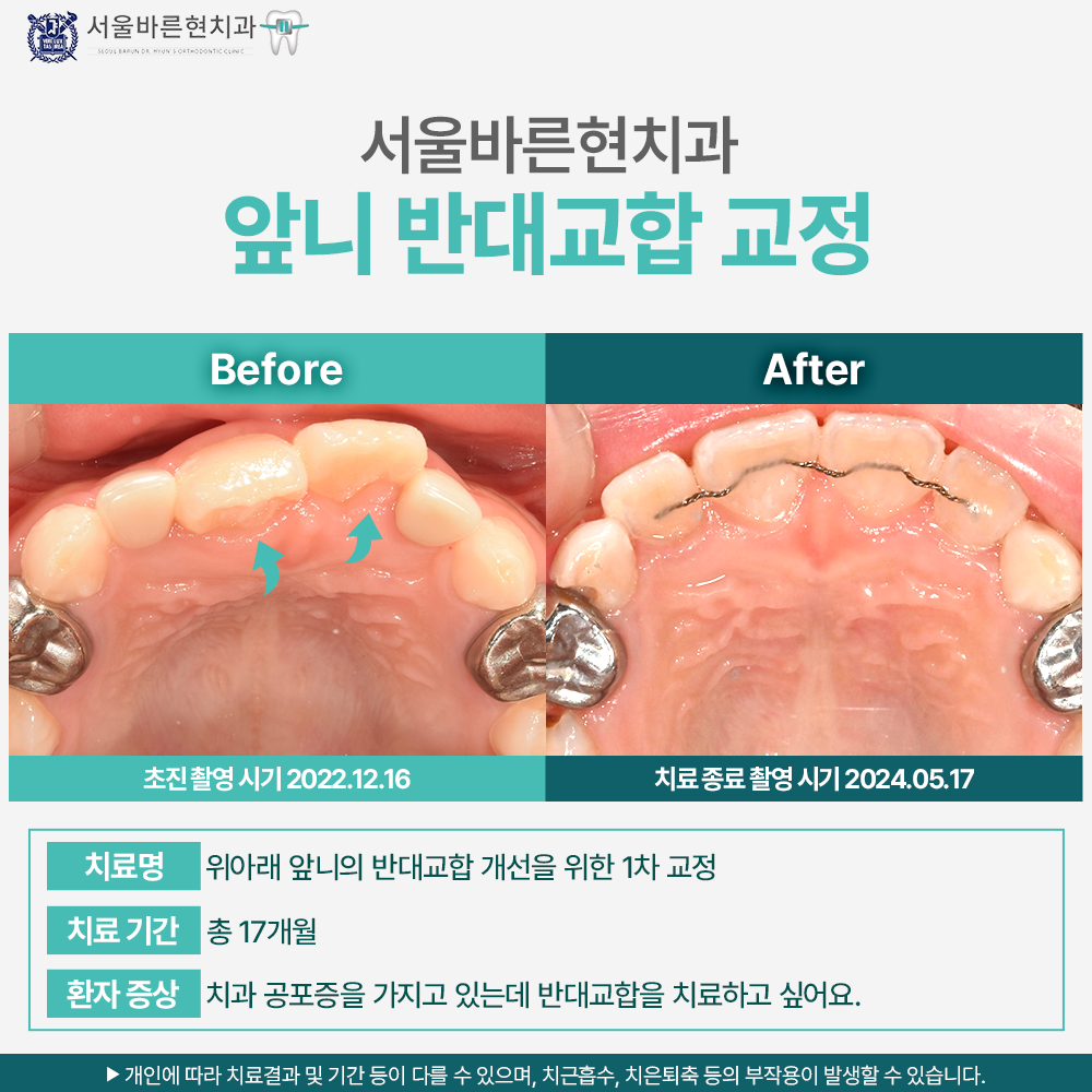 해운대앞니교정치과
