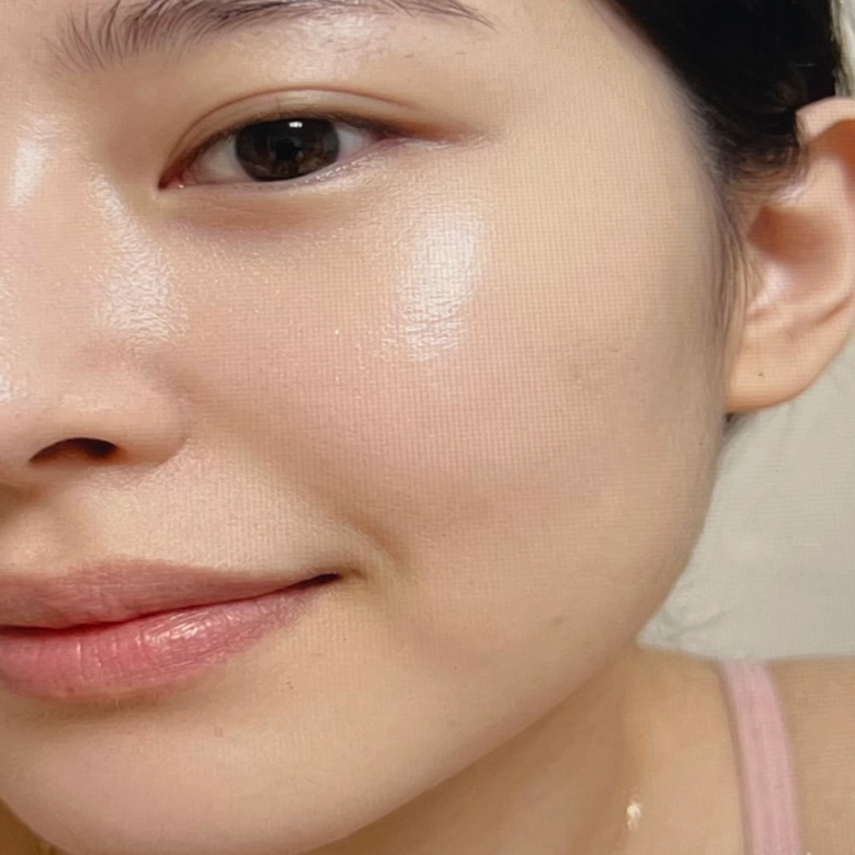 울쎄라 프라임 통증 효과 후기 증명하기위한 셀카 사진