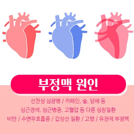 부정맥