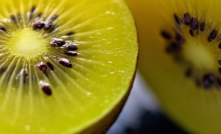 변비에 좋은 과일 키위