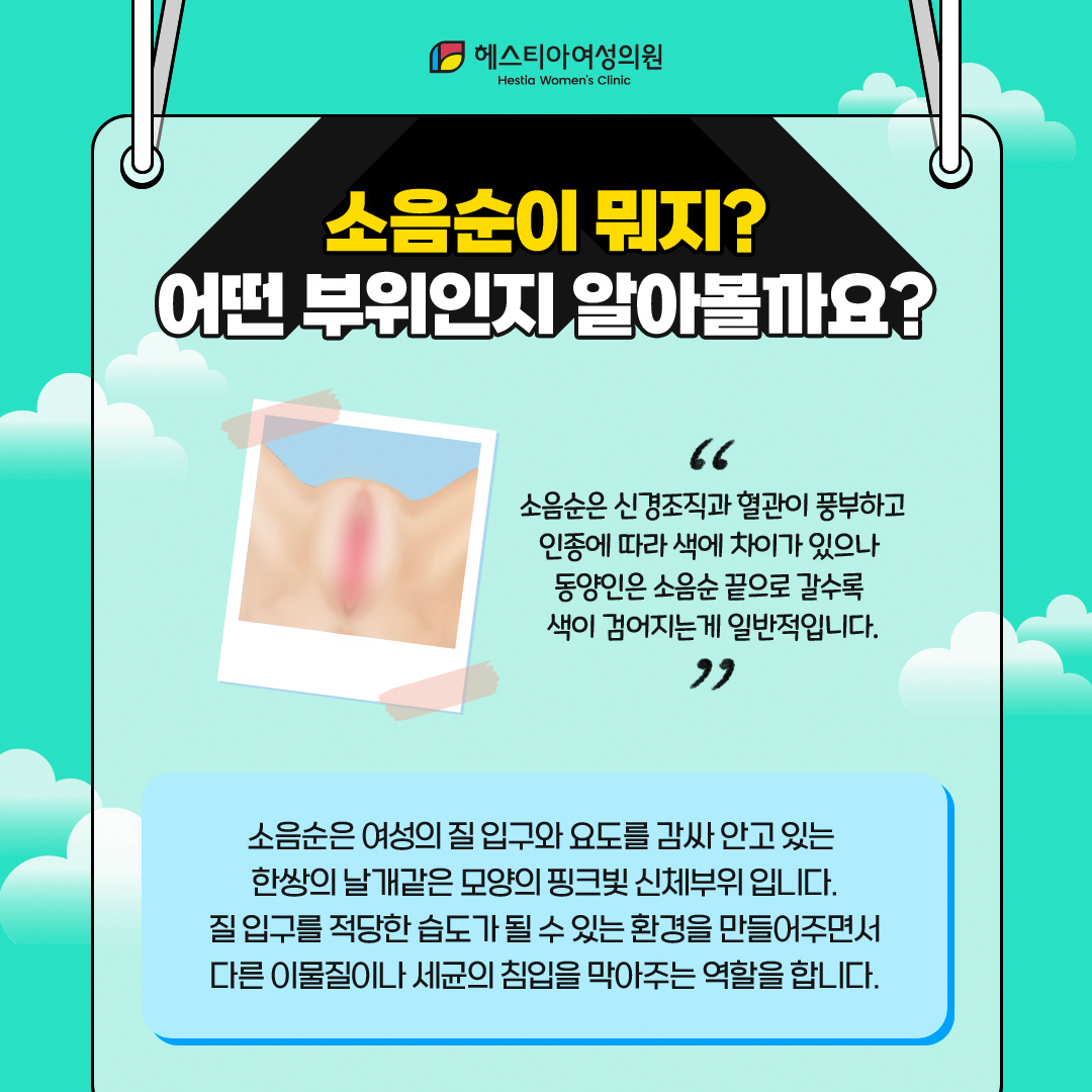 소음순이뭐지?