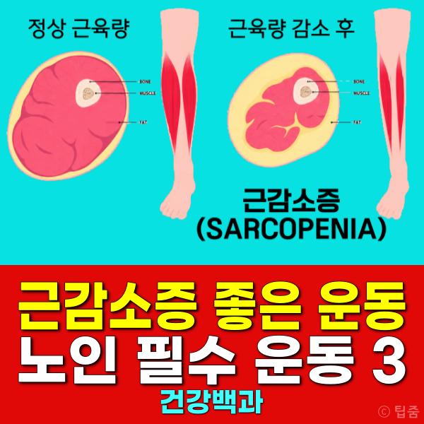 근감소증에 좋은 하체운동 노인 필수 운동