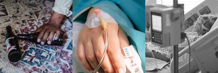 알코올-전문병원