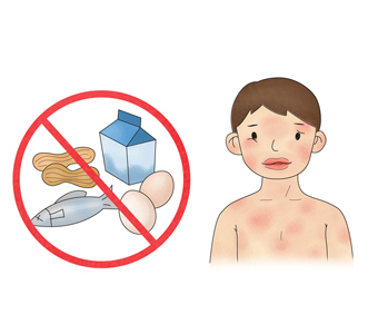 음식물 알레르기 썸네일