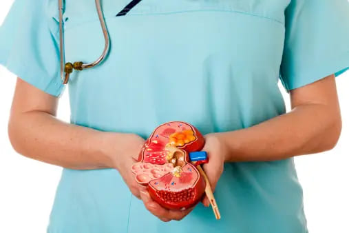 신장 결석의 원인