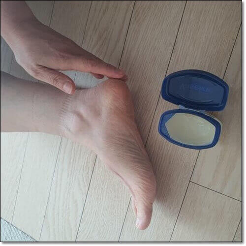 발 뒷꿈치 통증