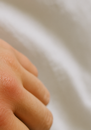 관절염 초기증상